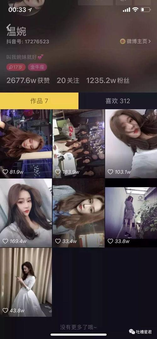 抖音吃瓜群众怎么加入,轻松加入瓜圈，畅享娱乐盛宴